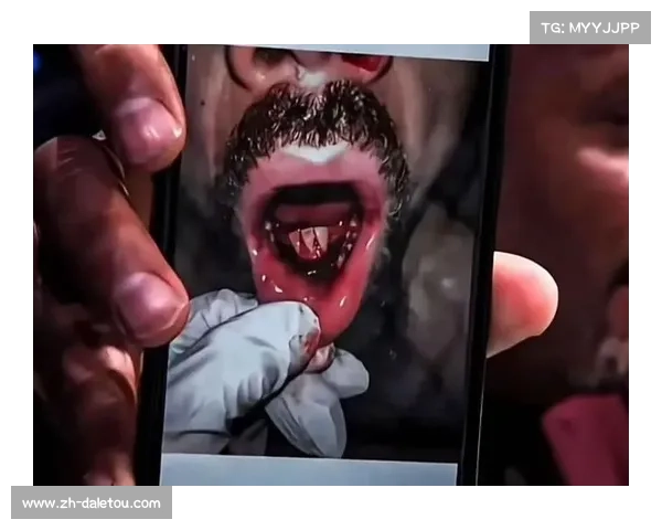 奇马耶夫中量级夺冠后计划手术，UFC中量级进入狼王时代